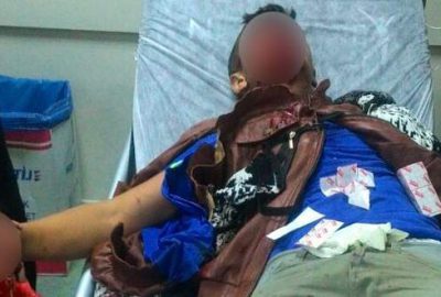 Polise atmak istediği bomba elinde patladı