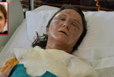 Uyuyan gelinin yüzüne kızgın yağ döktü