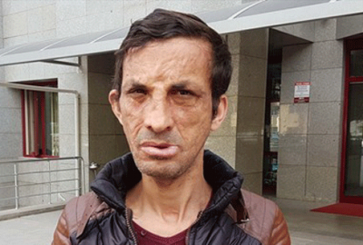 Yüz nakli olan Acar cinayetle suçlanıyor