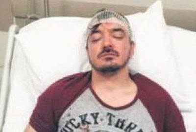 Ünlü sanatçı komşuları tarafından bıçaklandı