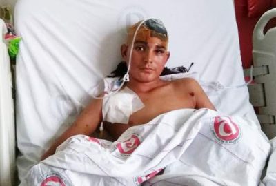 Sokak köpeklerinin saldırdığı çocuk ölümden döndü