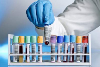 Vatandaşın cebinden tek kuruş çıkmayacak