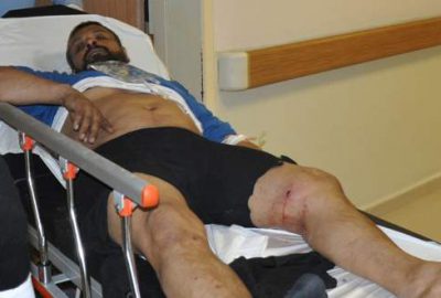 Bursa’da silahlı baltalı kavga