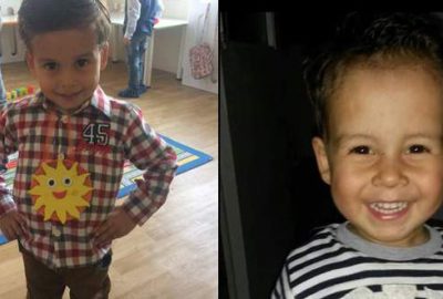 Yangında kalbi duran minik Kayra yaşam mücadelesi veriyor