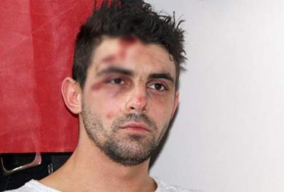 Rotterdam’da yaralanan Türk vatandaşı, o anları anlattı