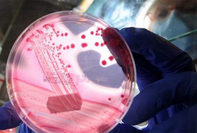 Bilim adamları, dirençli bakterileri antibiyotiklere yeniden duyarlı hale getirmenin yolunu