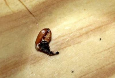 Kulağından filizlenmiş buğday çıktı