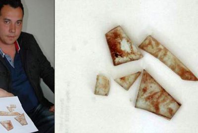 Ameliyatta unutulan cama 10 bin lira