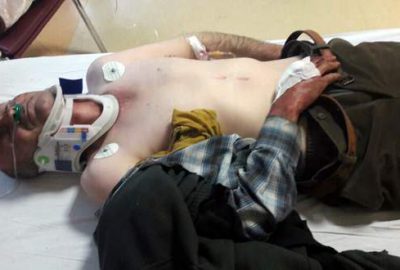 Yaralı halde yol kenarında bulundu