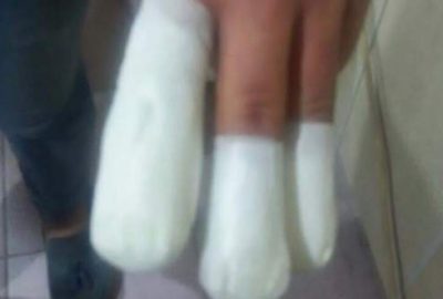 Havai fişek elinde patladı