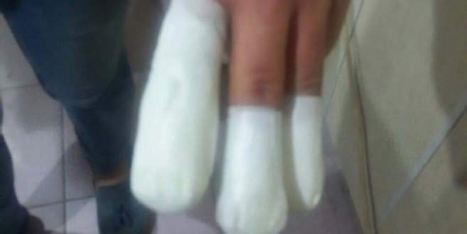 Havai fişek elinde patladı