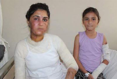 Evde uyurken asitli saldırıya uğradılar