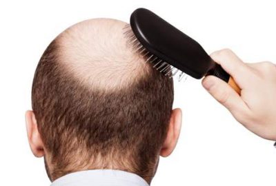 Kelliğe neden olan hücreler ilk kez keşfedildi