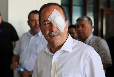 Belediye başkanına yumruklu saldırı