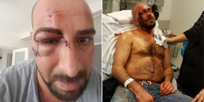 Belçika’da Türk vatandaşına ırkçı saldırı