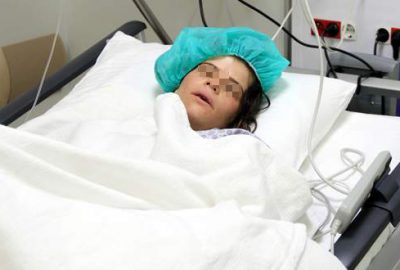 Eşi levyeyle dövüp, kerpetenle dişlerini söktü! Şikayetçi olmadı…