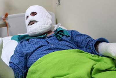 Biriken gaz bomba gibi patladı