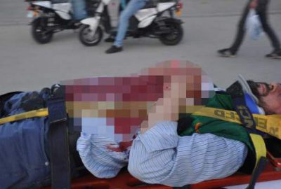Motosikletin aynası göğsüne saplandı, kanlar içinde kaldı