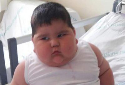 Samsun'da yaşayan Sedat-Sevda Bekte çiftinin "leptin (tokluk) hormonu eksikliği" teşhisi