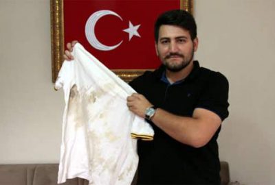 Vücudundaki 20 şarapnel parçasıyla yaşıyor