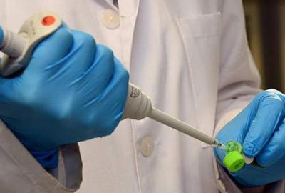 AIDS hastalarının yarıya yakını ilaç tedavisi göremiyor