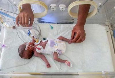 Van'da 2,5 ay önce 660 gram olarak dünyaya gelen ve