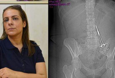 Karnında unutulan makasla 6 ay yaşadı