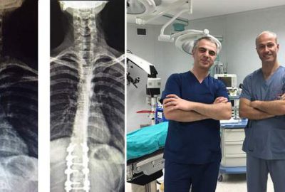 Bursa’da omurga eğriliği ameliyatları başladı