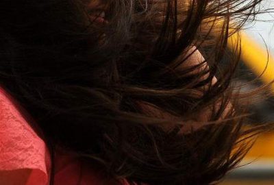 Türk Dermatoloji Derneği Yönetim Kurulu Üyesi Şentürk, kadınlarda saç dökülmesinde