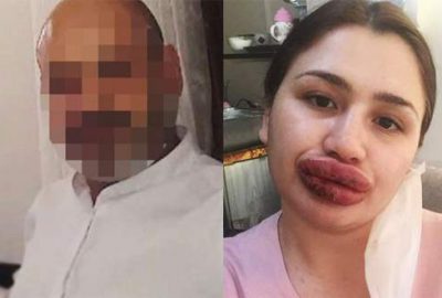 ‘Sahte estetikçi’ kuaför cezaevinden kaçtı