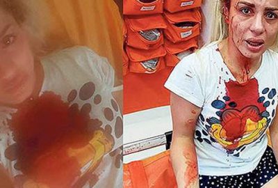 Genç kadını bu hale getirdi! Taciz ettikten sonra…