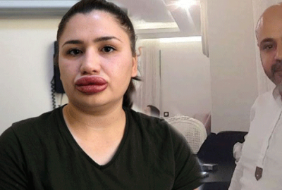 Cezaevinden kaçan ‘sahte estetikçi’ yakalandı