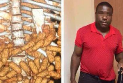 Midesinden 85 kapsül kokain çıktı