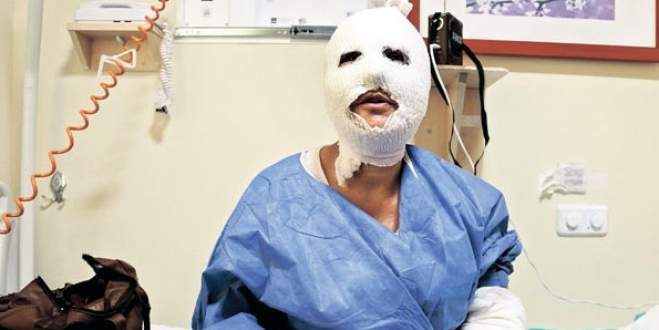 Düdüklü tencere patladı, bu hale geldi!