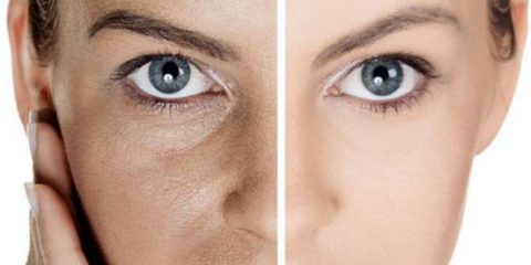 Ciltteki Gozenekleri Sikilastirmak Icin Dogal Yontemler Olay Gazetesi Bursa Ciltteki Gozenekleri Sikilastirmak Icin Dogal Yontemler Olay Gazetesi Bursa