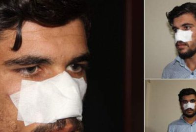 Kuzen dehşeti! Burnunu kopartıp yere attı