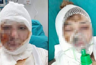 Savcı itiraz etti, kezzaplı saldırgan gözaltına alındı