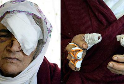 Bahçede bulduğu kutu elinde patladı! Gözünü kaybedebilir