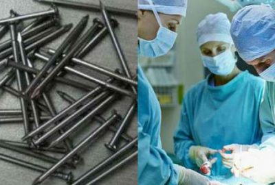 Mide ağrısından hastaneye gitti, doktorları şoke etti!