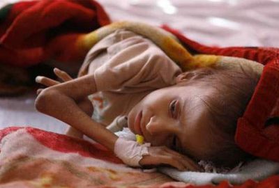 Dünyanın en büyük açlık krizi