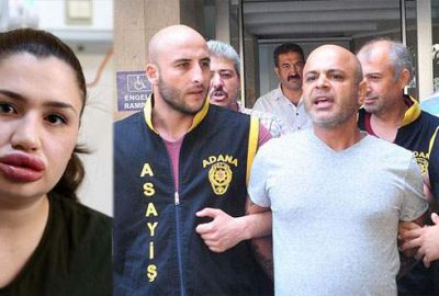 Sahte estetikçinin cezası belli oldu