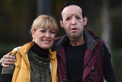 Yüz nakli yapılan Recep Sert tutuklandı