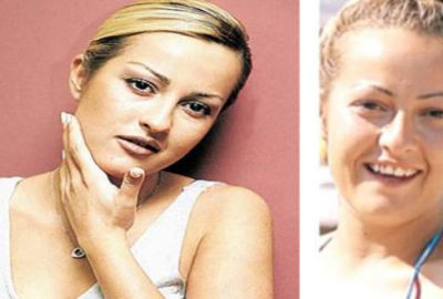 Şimdiki halini görenler tanıyamıyor!