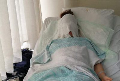 Dehşet! Erkek arkadaşı yüzüne kimyasal madde attı