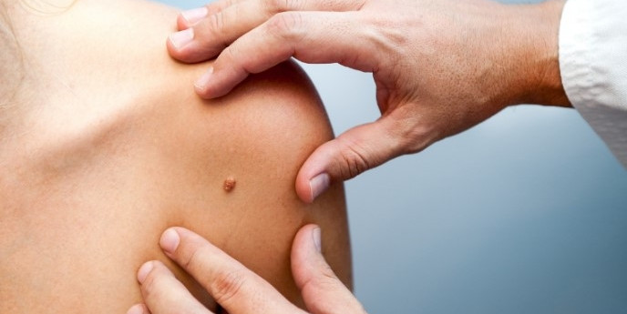 Benlerinizi düzenli olarak takip edin! Benlerinizi düzenli olarak takip edin!