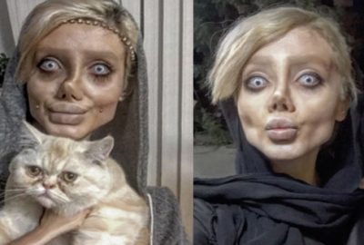 Ünlü yıldıza benzemek için bıçak altına yattı, sonuç facia!