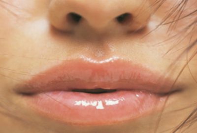 Dudak çatlamasına doğal çözüm