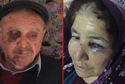 Vicdansızlık! Yaşlı çifti darp edip paralarını gasp ettiler