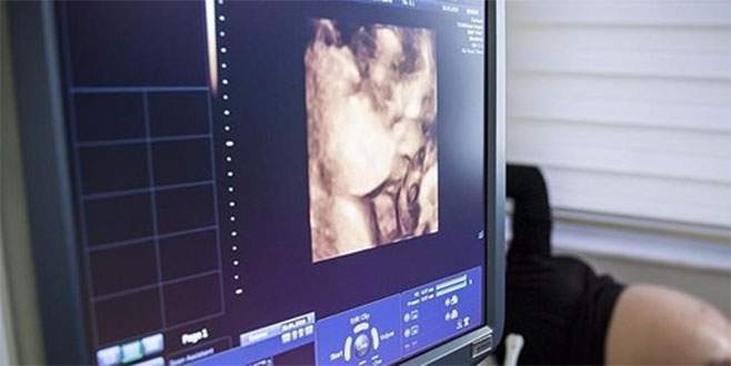 Doğumda hayat kurtaran yöntemde Türk imzası Doğumda hayat kurtaran yöntemde Türk imzası