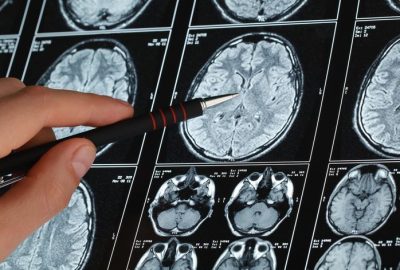 O hastaların yüzde 30’u üfürükçüden medet umuyor!